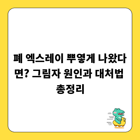 폐 엑스레이 뿌옇게 나왔다면? 그림자 원인과 대처법 총정리